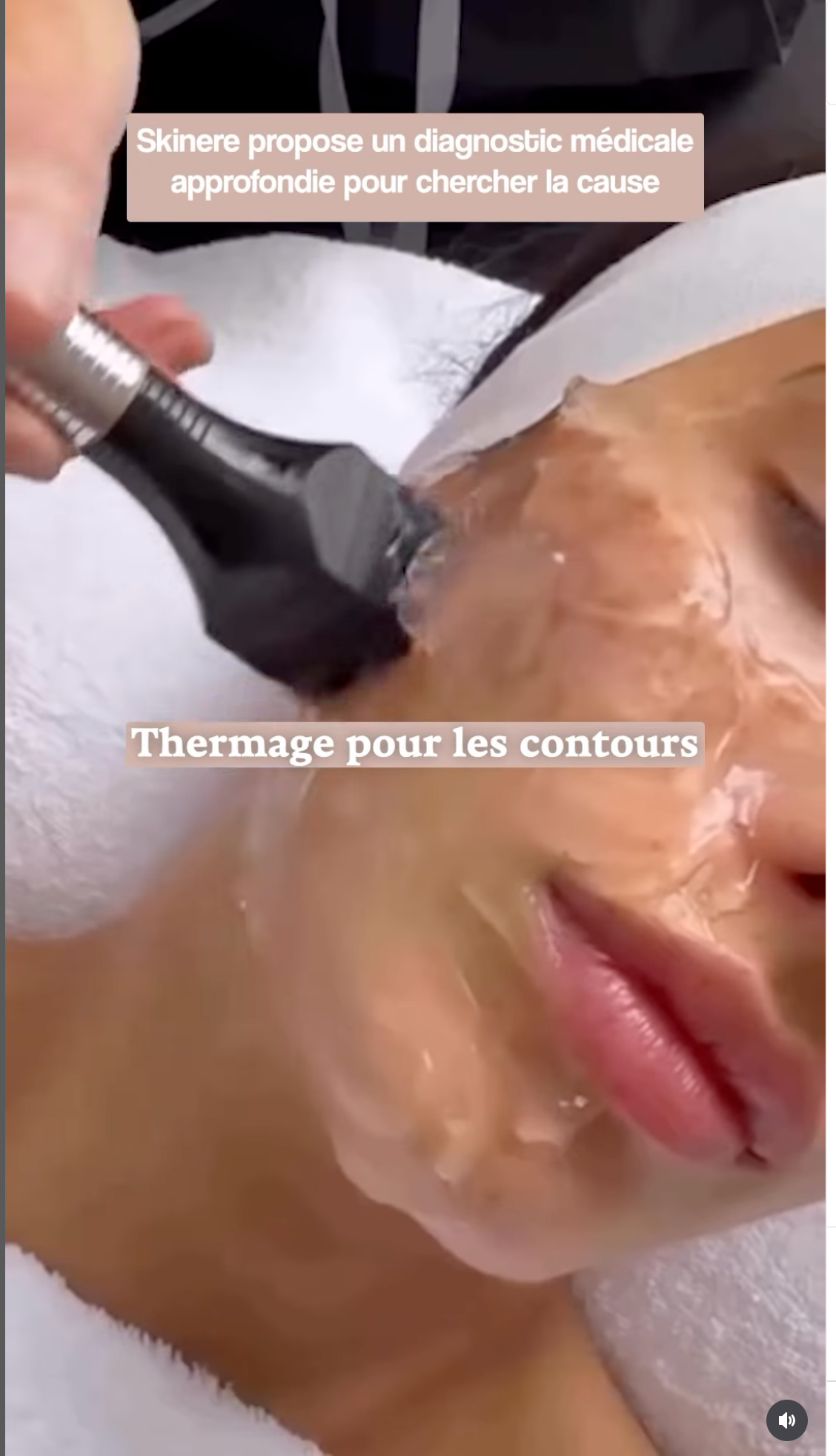 SKINERE - Post Instagram 6